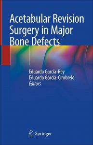Acetabular Revision Surgery in Major Bone Defects. 2019