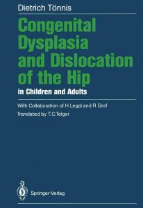 Dietrich Tönnis-Congenital Dysplasia and Dislocation of the Hip in Children and Adults 