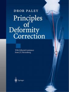 Dror Paley-Principles of Deformity Correction. 1st ed.